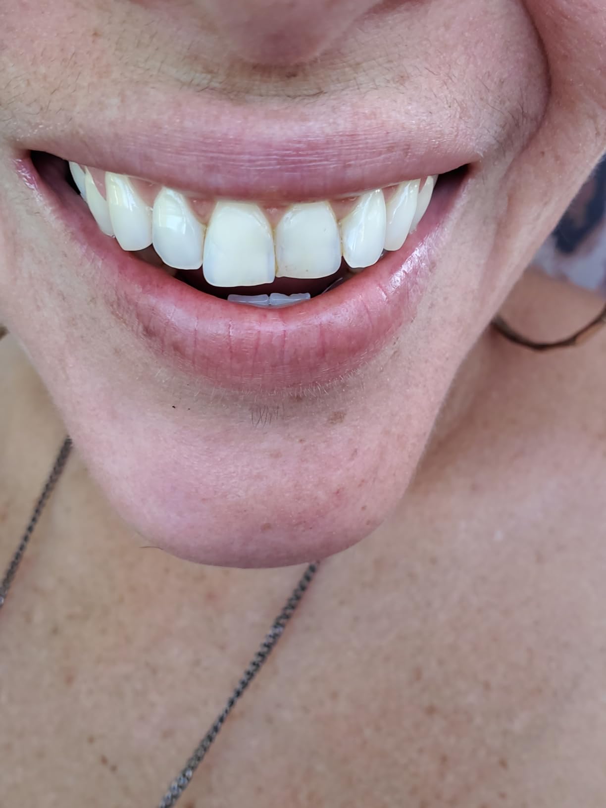 Lumineux Teeth Whitening Mouthwash, 16 Oz. 2 Pack - Peroxide Free - Whitening Without The Sensitivity - NO Alcohol, Fluoride & SLS Free - Customer Photo 1