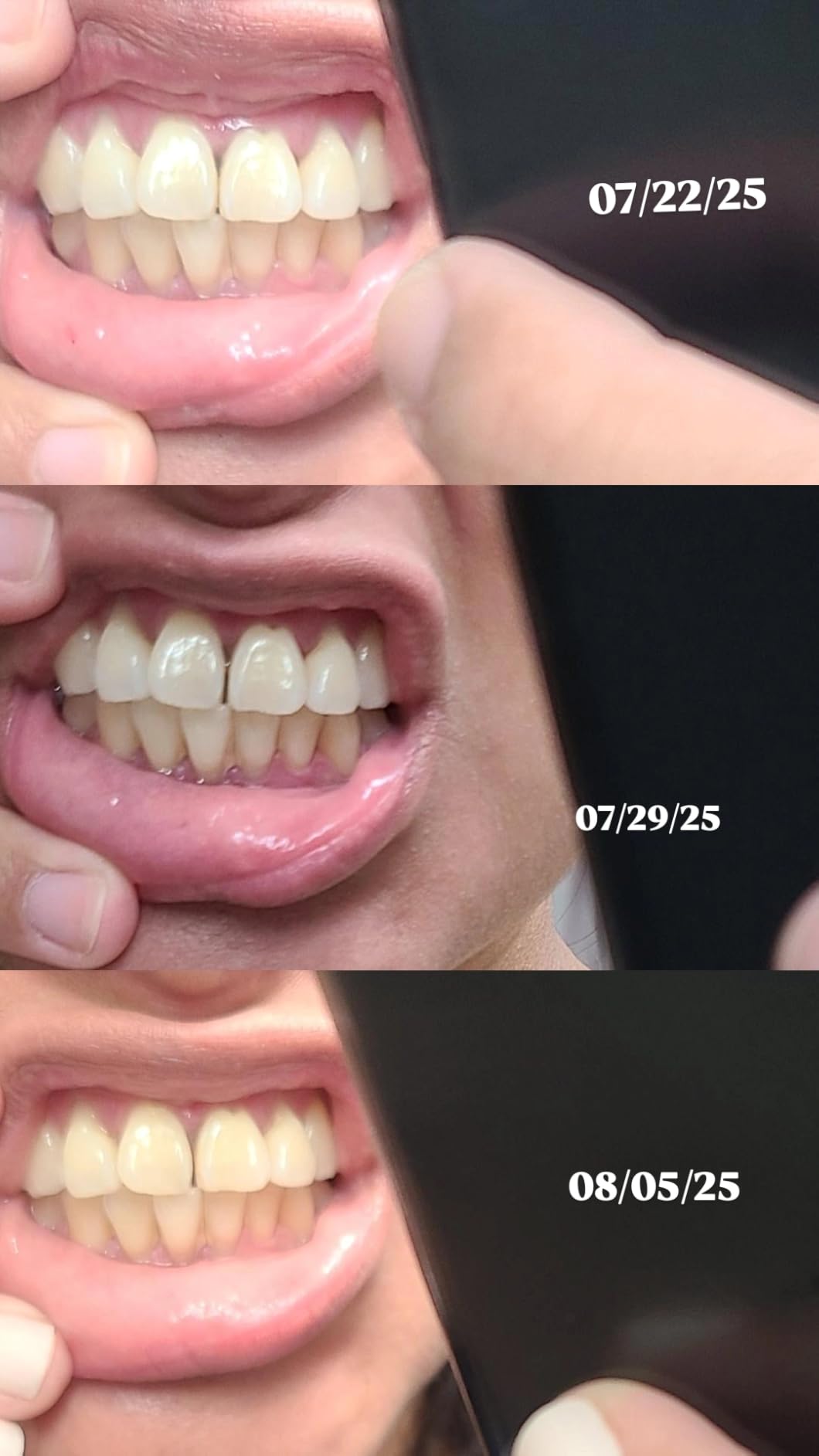 GuruNanda CocoMint Oil Pulling Mouthwash for Complete Oral Hygiene, 7 Essential Oils & Vitamins for Happy Teeth & Gums & Fresh Breath , Alcohol-Free, 8 oz - Customer Photo 1