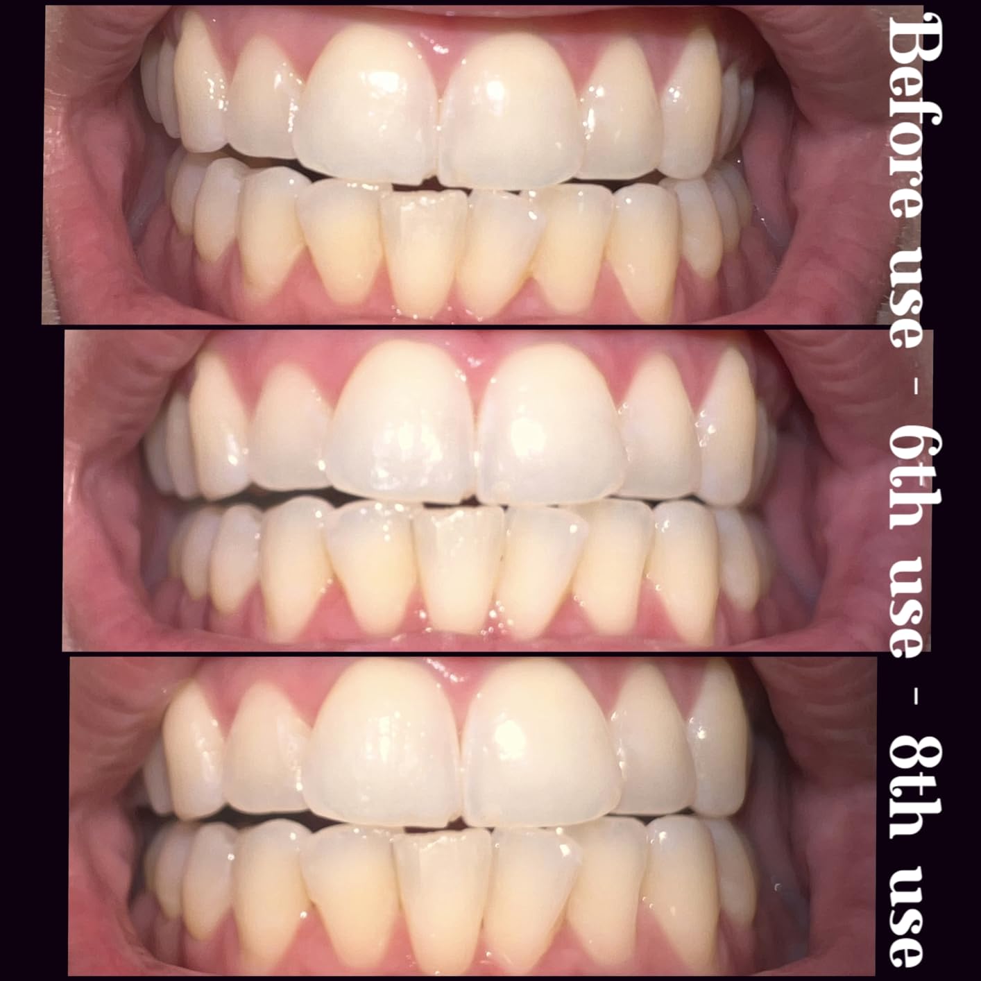 GuruNanda CocoMint Oil Pulling Mouthwash for Complete Oral Hygiene, 7 Essential Oils & Vitamins for Happy Teeth & Gums & Fresh Breath , Alcohol-Free, 8 oz - Customer Photo 2