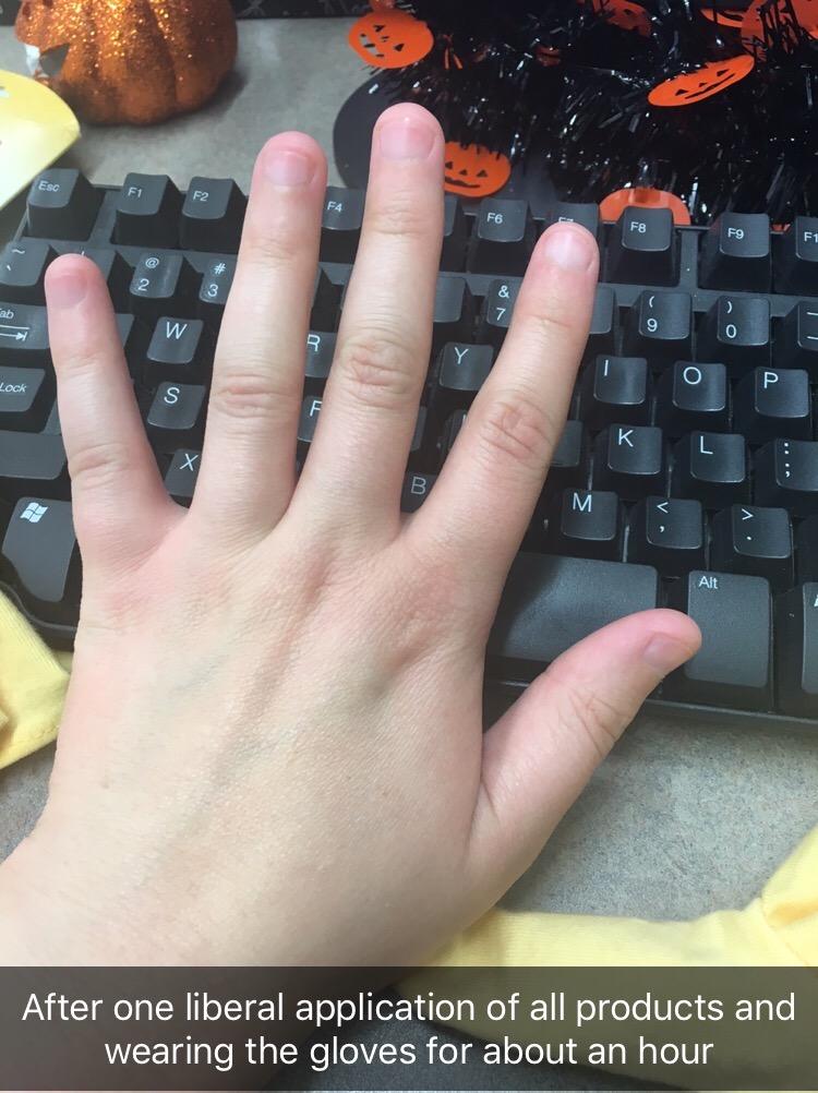 Burt's Bees Gifts Ideas - Classics Set, 6 Products in Giftable Tin – Cuticle Cream, Hand Salve, Lip Balm, Res-Q Ointment, Hand Repair and Foot Cream - Customer Photo 2