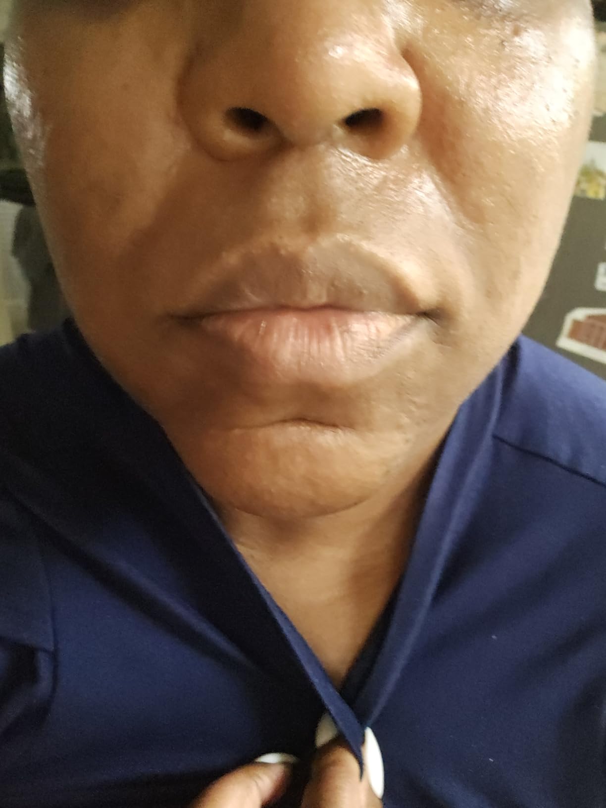 Paula's Choice CLINICAL 20% Niacinamide Vitamin B3 Concentrated Face Serum, Anti-Aging Serum for Face, Treatment for Discoloration & Minimizing Large Pores, Fragrance-Free, 0.67oz Customer Review Paula's Choice CLINICAL 20% Niacinamide Vitamin B3 Concentrated Face Serum, Anti-Aging Serum for Face, Treatment for Discoloration & Minimizing Large Pores, Fragrance-Free, 0.67oz - Customer Photo 1