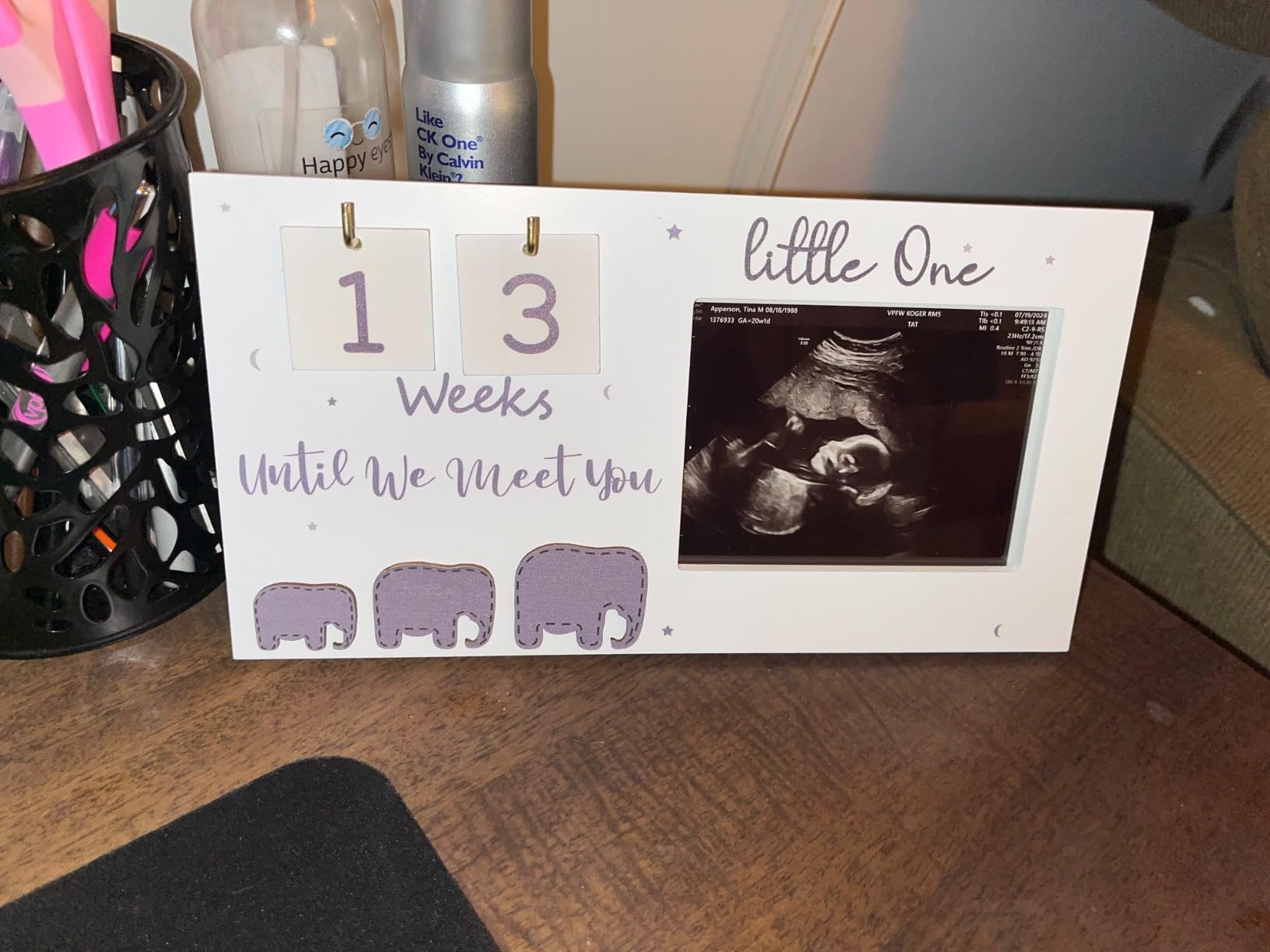 Sonogram Picture Frame, Ultrasound Photo Frame with Baby Countdown Weeks, Expecting Parents to be Pregnancy Gift Congratulations Pregnancy Must Have Grandparent Baby Announcement First Time Mom to Be - Customer Photo 1