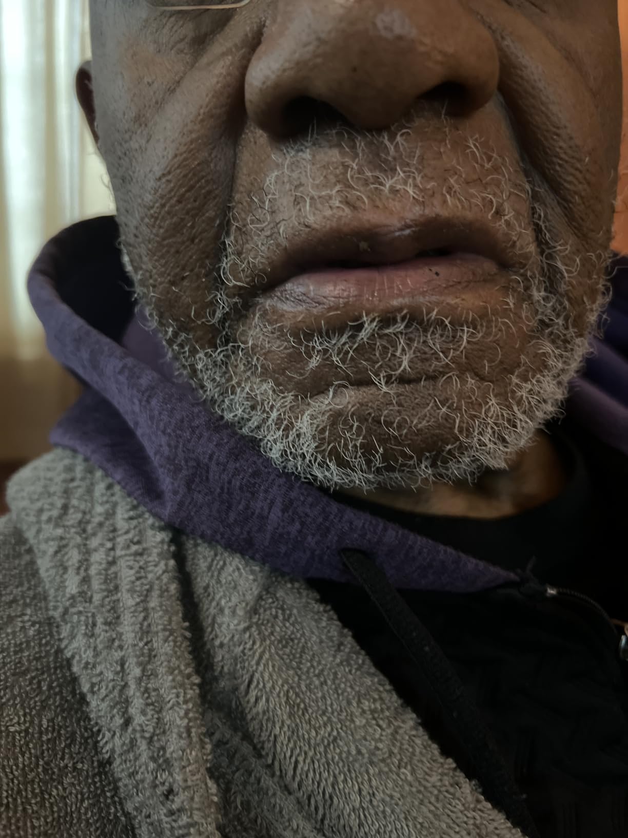 MANSCAPED® The Beard Hedger® Premium Men's Beard Trimmer, 20 Length Adjustable Blade Wheel, Stainless Steel T-Blade for Precision Facial Hair Trimming, Cordless Waterproof Wet/Dry Clipper - Customer Photo 1