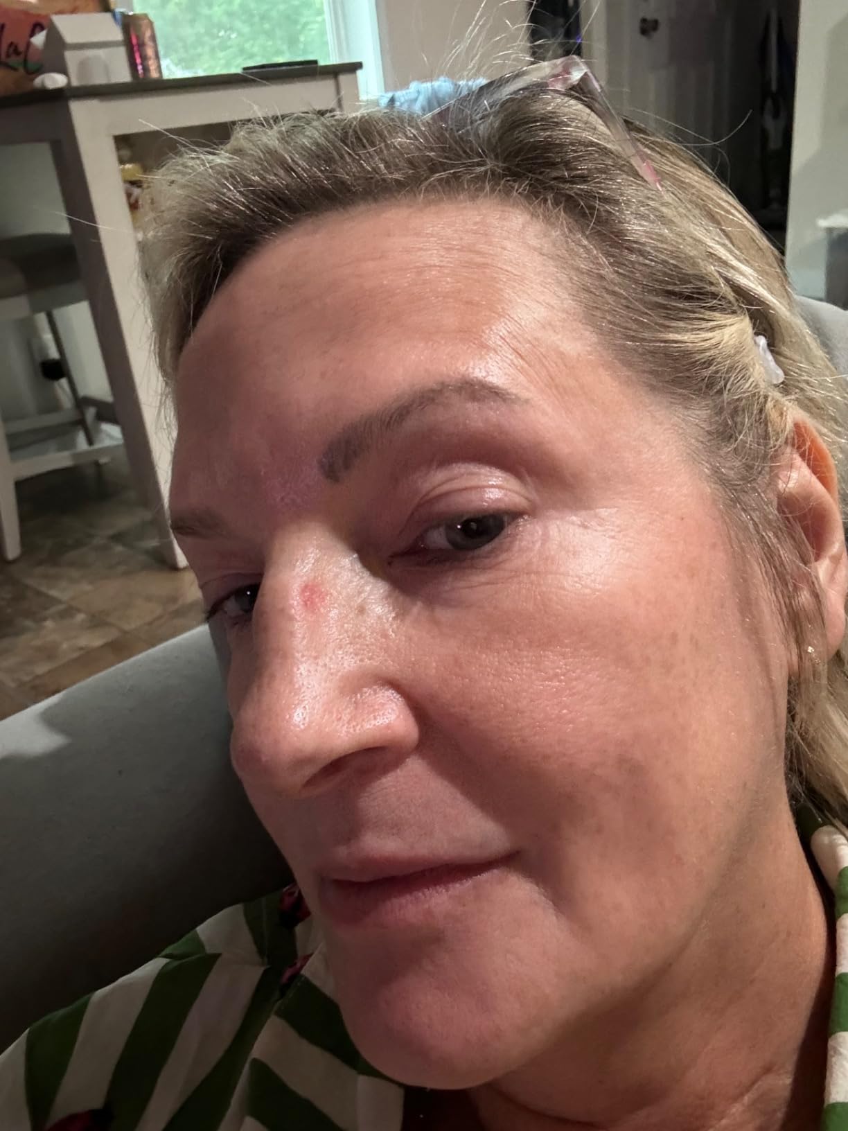 Glow Recipe Fruit Babies Skincare Kit - Gift Set with Ceramide Facial Cleanser + BHA Toner + Vitamin C Eye Cream + Hyaluronic Acid Cream + Niacinamide Dew Drops (5 Count) - Customer Photo 3