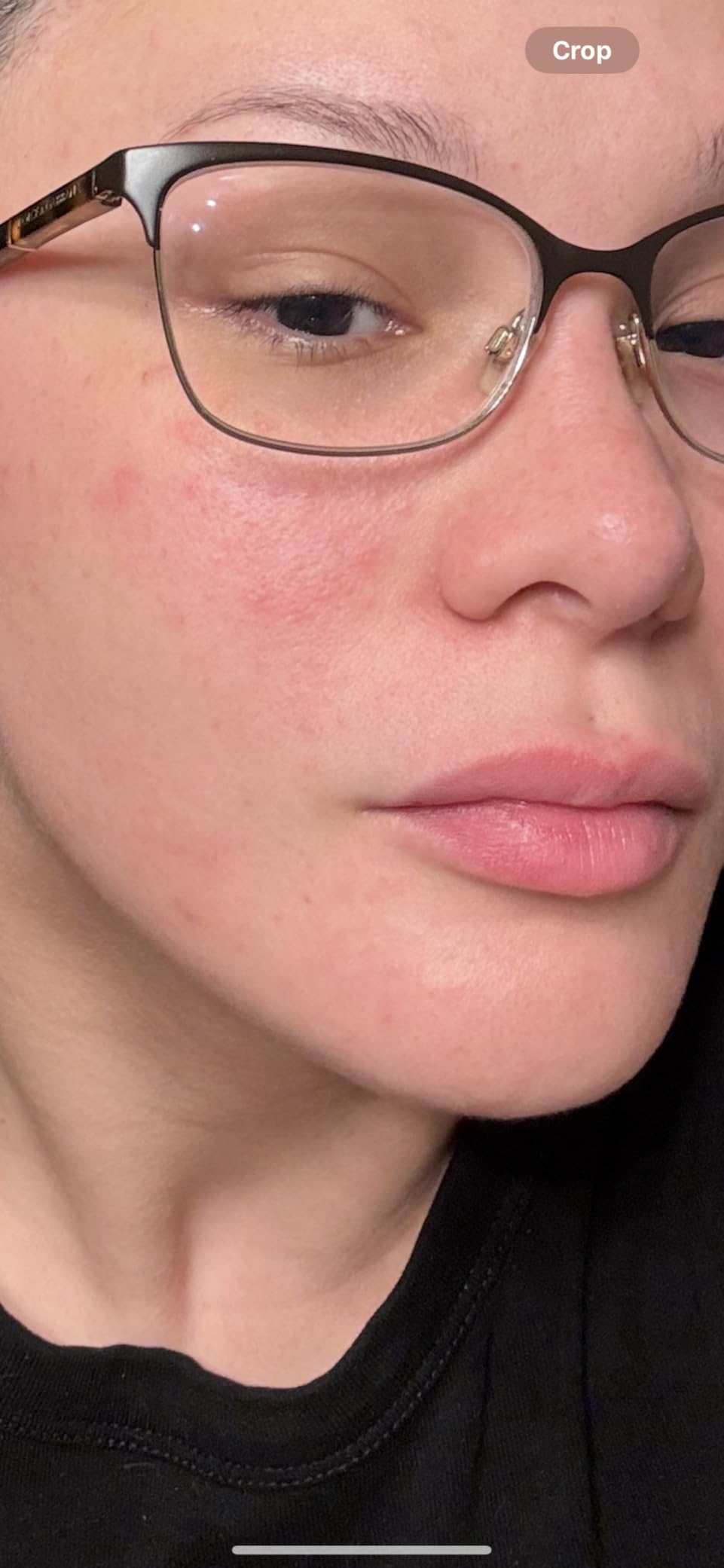 Ulike ReGlow LED Light Therapy Mask, Red Light Therapy for Face, 4 Modes with Red, Blue, Yellow & Infrared Lights for Reduce Acne & Anti-Aging, Eye-Protection, 272 Beads, Remote Control,White - Customer Photo 1