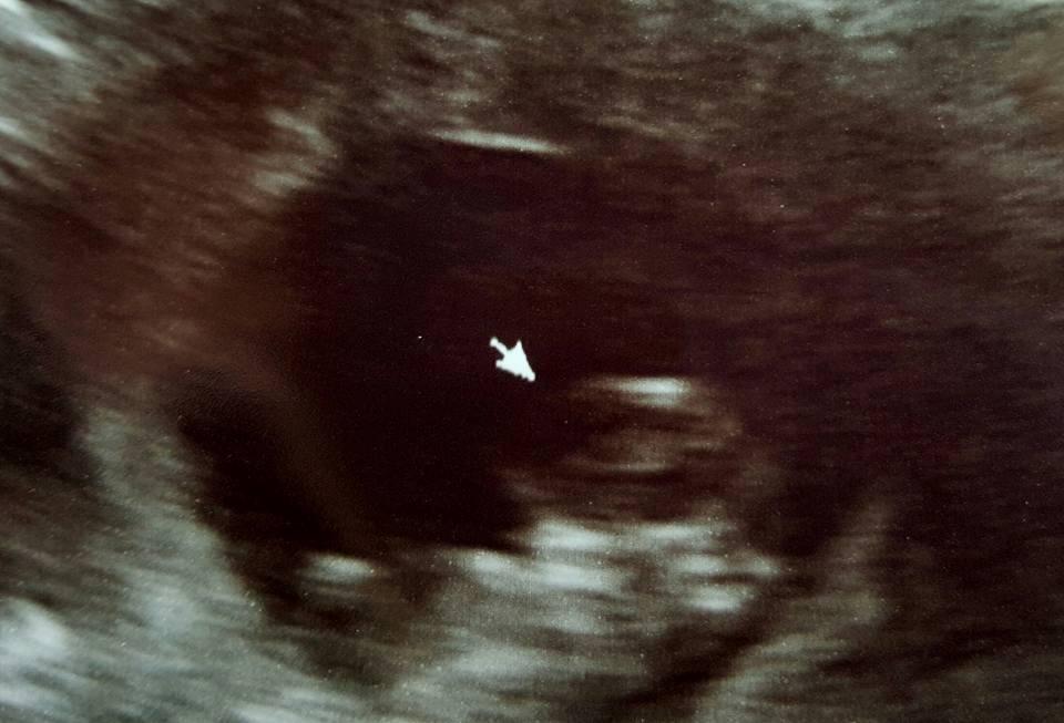 Daily Wellness Fertility Blend for Women - Fertility Supplements for Women, Conception Fertility Prenatal Vitamins, Trying to Conceive Progesterone Supplements, Cycle Support Conception Pills - 1 Pack - Customer Photo 1