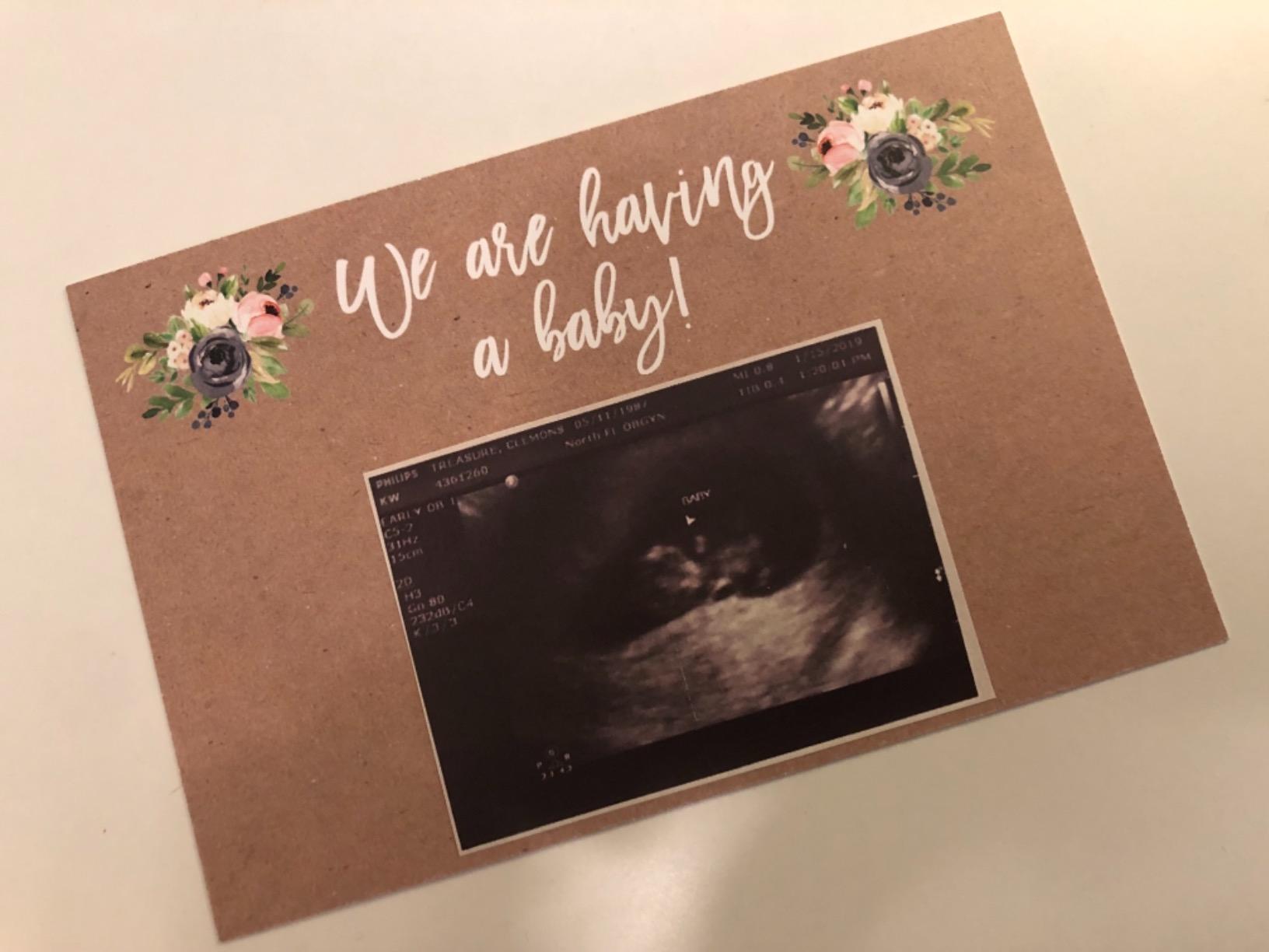 25 Pregnancy Announcement Card Set, We're Expecting Baby Surprise Having Birth Reveal Only Best Friends Get Promoted To Auntie Aunt Uncle Grandpa Grandma Grandparent Sister Brother Family Dad Mom Customer Review 25 Pregnancy Announcement Card Set, We're Expecting Baby Surprise Having Birth Reveal Only Best Friends Get Promoted To Auntie Aunt Uncle Grandpa Grandma Grandparent Sister Brother Family Dad Mom - Customer Photo 1