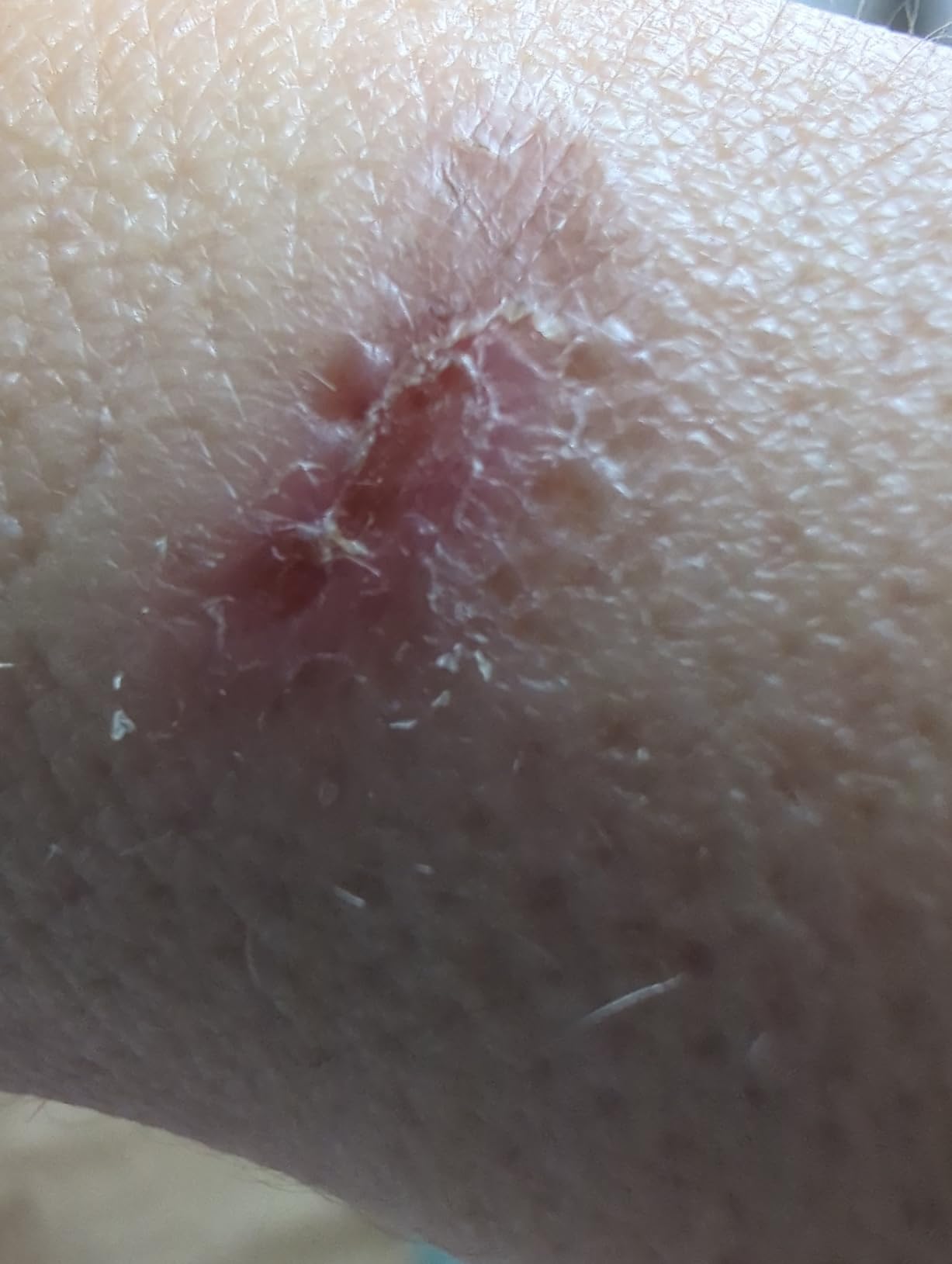 The Original Korcci Microwaveable Silicone Popcorn Popper, Microwave Popcorn Popper, Collapsible Microwave Popcorn Maker Bowl, No Oil Required, Use In Microwave, Dishwasher Safe (Blue) - Customer Photo 1