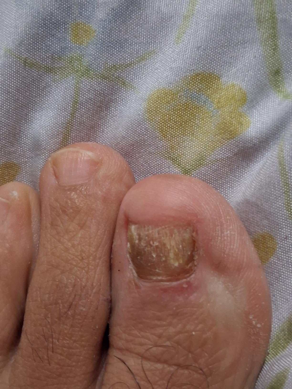 PURA D'OR Organic Lavender Essential Oil (4oz with Glass Dropper) 100% Pure & Natural Therapeutic Grade for Hair, Body, Skin, Aromatherapy Diffuser, Relaxation, Meditation, Massage, Home, DIY Soap - Customer Photo 1