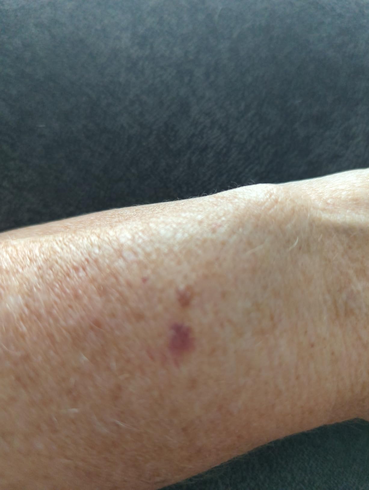 Fitbit Versa 4 Fitness Smartwatch with Daily Readiness, GPS, 24/7 Heart Rate, 40+ Exercise Modes, Sleep Tracking and more, Black/Graphite, One Size (S & L Bands Included) Customer Review Fitbit Versa 4 Fitness Smartwatch with Daily Readiness, GPS, 24/7 Heart Rate, 40+ Exercise Modes, Sleep Tracking and more, Black/Graphite, One Size (S & L Bands Included) - Customer Photo 2