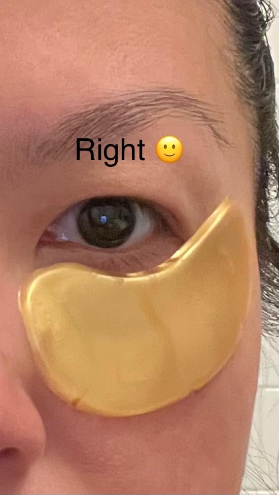 grace & stella Under Eye Patches (12 pairs) Eye Masks for Puffy Eyes and Dark Circles - Stocking Stuffers for Teen Girls, Christmas Gifts for Women, White Elephant Gifts, Birthdays, Holidays - Vegan - Customer Photo 3